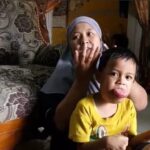 Kisah Febio, Bocah 6 Tahun Berjuang Melawan Tumor Lidah Sejak Lahir