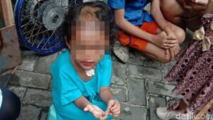 Paman dan Bibi di Surabaya Diringkus Polisi atas Dugaan Penganiayaan Balita 4 Tahun