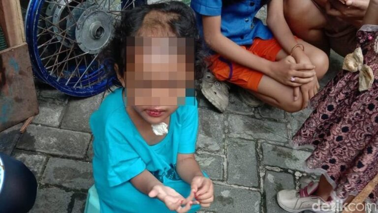 Paman dan Bibi di Surabaya Diringkus Polisi atas Dugaan Penganiayaan Balita 4 Tahun