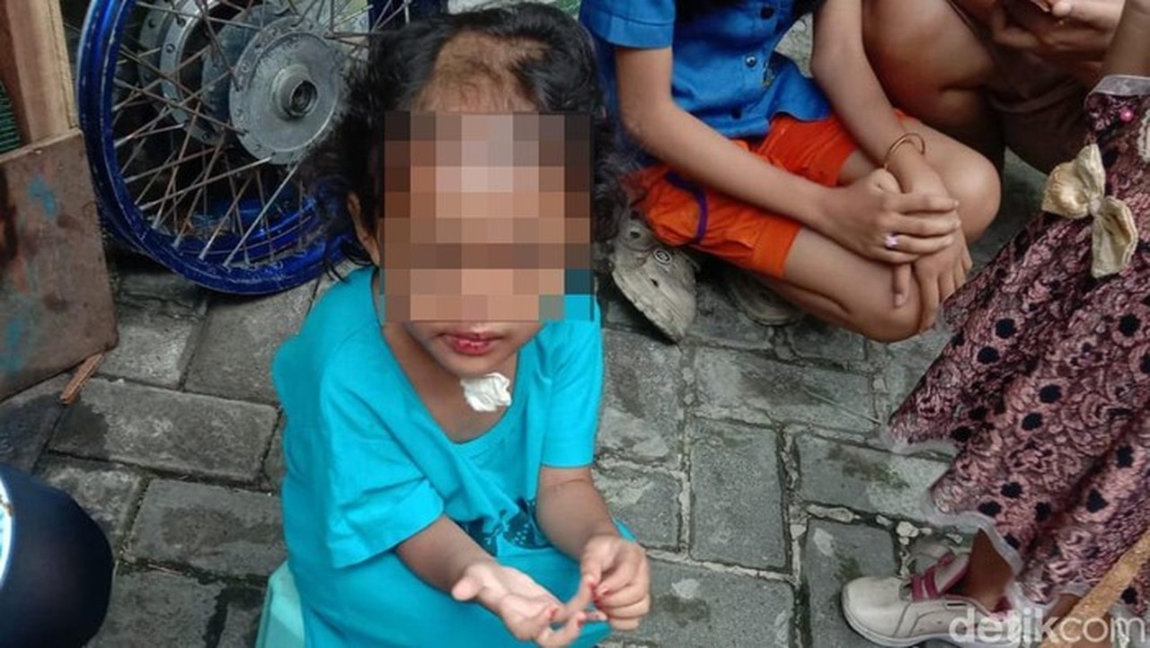 Paman dan Bibi di Surabaya Diringkus Polisi atas Dugaan Penganiayaan Balita 4 Tahun Paman dan Bibi di Surabaya Diringkus Polisi atas Dugaan Penganiayaan Balita 4 Tahun