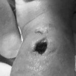 Bayi di Makassar Diduga Malpraktik, Tangan Berlubang Usai Diinfus RSIA Paramount